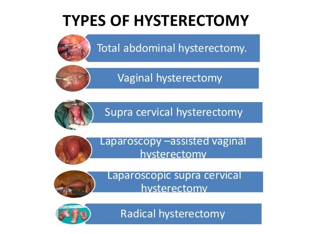 abdominal and vaginal hysterectomy Abdominal and vaginal hysterectomy